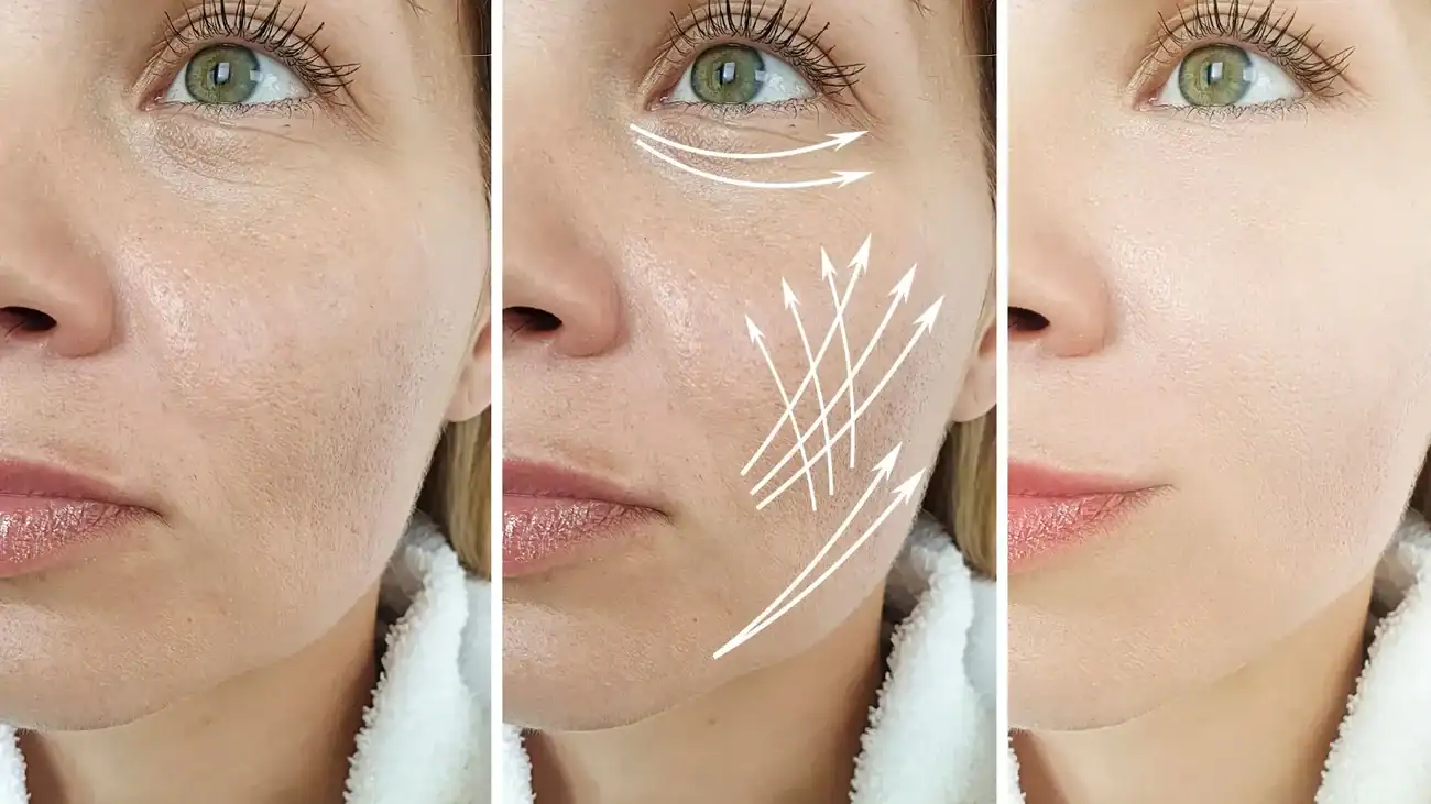 Can One Treatment Really Tackle More Than One Skin Concern Watford?