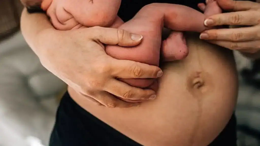 Why Is My Stomach Still Big After Pregnancy Watford?
